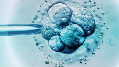 Monash IVF Chief Resigns
