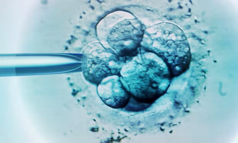 Monash IVF Chief Resigns